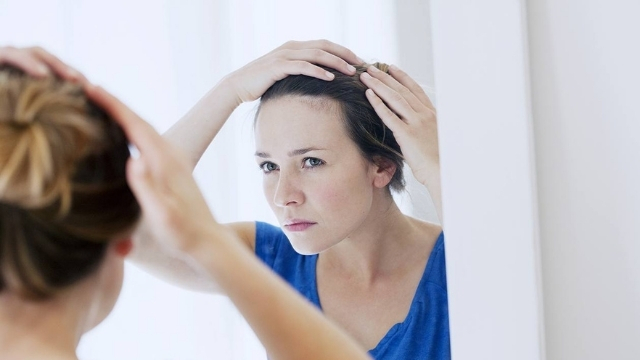 女性の薄毛の原因と効果的な対策10選【薄毛や抜け毛は治ります】